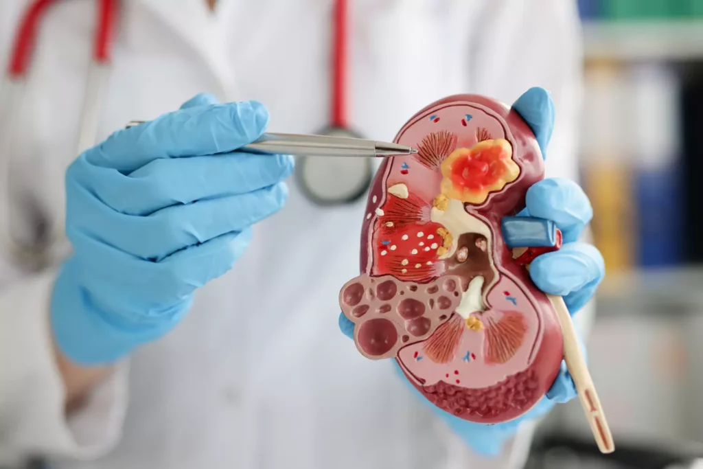 Médecin analysant une maquette anatomique d’un rein humain – métier de néphrologue