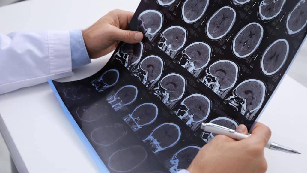 devenir neurologue